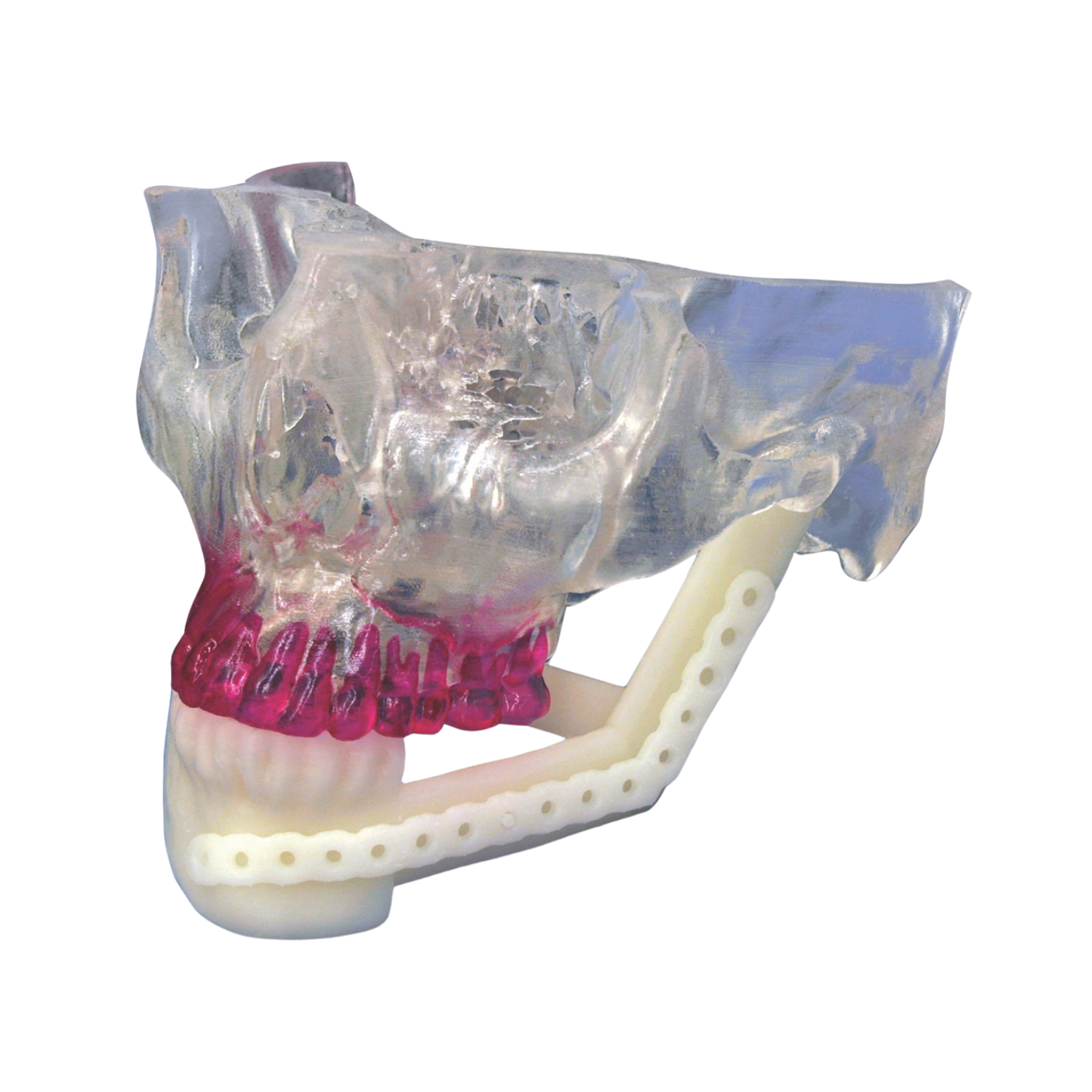 Cirugía Maxilofacial